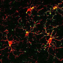 Image from study shows protein marker (green) that indicates activation of microglia (red) after exp